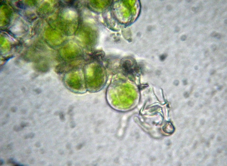 Microalga terrestre: Trebouxia sp